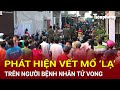 Bản tin sáng 16/11: Phát hiện vết mổ ‘lạ’ trên người bệnh nhân tử vong, Công an khẩn cấp vào cuộc