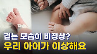 [톡투건강 우리 아이 걷는 모습이 이상해요] 소아정형외과 다리 이상의 최고 전문가가 알려주는 우리 아이 걷는 모습 정상일까 비정상일까?