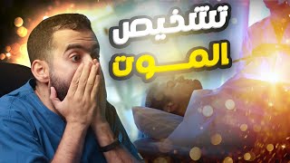 تشخيص الوفاة | علامات تؤكد موت المريض 😱