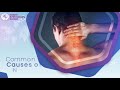 Common cause of Neck pain | Indore Arthroscopy Center