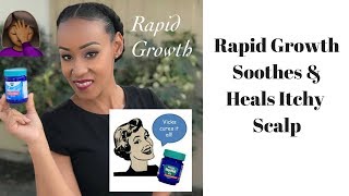 How I Apply Vicks Vapor Rub For Rapid Hair Growth