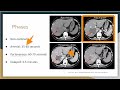 Understanding CT Abdomen Contrast Phases