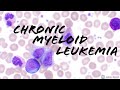 Chronic Myeloid Leukemia (CML) Peripheral Blood Smear (Hematopathology & Hematology)