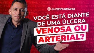 VOCÊ ESTÁ DIANTE DE UMA ÚLCERA VENOSA OU ARTERIAL?