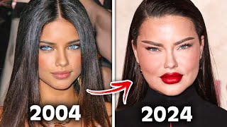 Top 10 Botched Plastic Surgery That DESTROYED Celebrities Careers