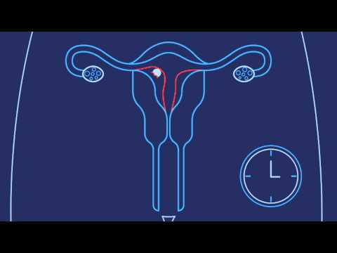 How Does Pregnancy Happen | Planned Parenthood Video How Does Pregnancy Happen | Planned Parenthood Video
