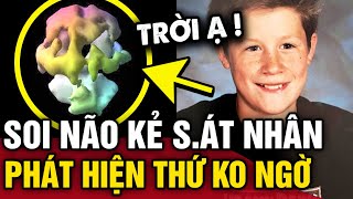 Nghiên cứu não của KẺ S.ÁT NHÂN, nhà khoa học phát hiện ĐIỂM KHÁC BIỆT với người thường | Tin 3 Phút