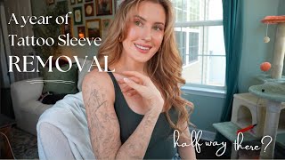 1 year of Tattoo Sleeve Removal!!// Half way there??