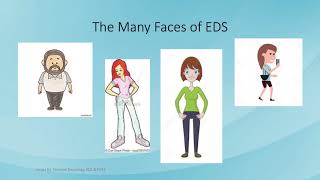 What is EDS