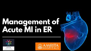 Management of Acute MI in ER || Investigations || ECG Findings