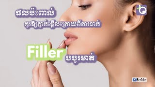 Lip Fillers | ផលប៉ះពាល់នៃការចាក់ Filler បបូរមាត់