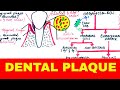 Dental Plaque : Structure, Composition & Formation