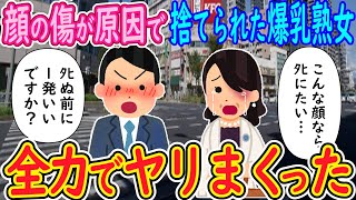 【2ch馴れ初め】顔の傷が原因で捨てられた爆乳熟女「こんな顔ならﾀﾋんだ方がマシ…」→全力で抱いた結果ｗｗｗ【ゆっくり解説】