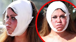 Celebrities Who Ruined Their Careers With Plastic Surgery | Marathon