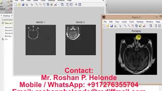Matlab code for Image Fusion using Wavelet Transform