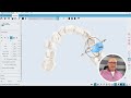 Maestro 3D | Dental Studio | User Video Tutorials | Unilabor | Tooth movement