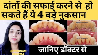 दांतो की सफाई करने से दांतो को क्या नुकसान हो सकता है ? Side Effects Of Dental Scaling ||