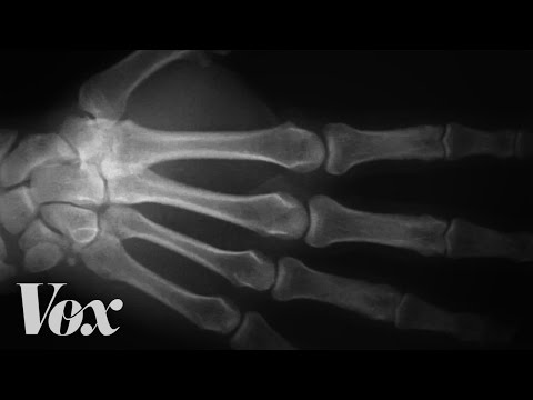 Here's what happens to your knuckles when you crack them Here's what happens to your knuckles when you crack them