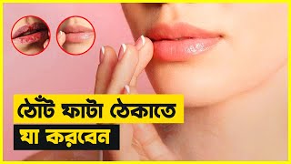 শীতে ঠোঁট ফাটা ঠেকাতে যা করবেন। ঠোঁট ফাটা দূর করার উপায় | Beauty Tips \u0026 Tricks | BD LifeStyle King