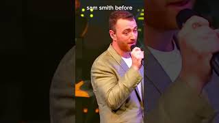 Sam smith before and after 😢
