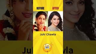 Bollywood | Before & After #shorts #beforeafter #bollywood