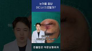 눈꺼풀 피지낭종 표피낭종 지방종 (양성종양 치료 수술 병원 부작용 안검하수)[아문TV]