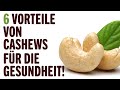 6 VORTEILE VON CASHEWS FÜR DIE GESUNDHEIT! | Vorteile von | Tipps für ein Gesundes