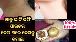 ଖଣ୍ଡେ ଆଳୁ ଆଉ ଟିକେ କଫି ପାଉଡର କମାଲ/15 ମିନିଟ୍ ରେ ପୁରା ସଫା ହେବ ବେକ ପାଦ ହାତ ଆଣ୍ଠୁ/(@Sony kitchen \u0026 Vlog)