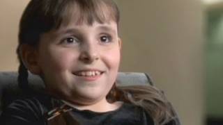 Follow-up Care - Scoliosis and Thoracic Insufficiency Syndrome (8 of 8)