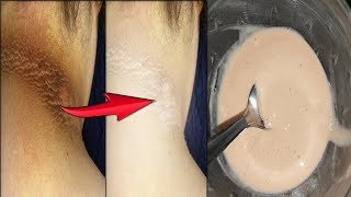 #NeckWhitening ஒரே நாளில் உங்க கழுத்தில் உள்ள கருமையை நீக்கலாம் | Remedy for  Neck Darkness ||