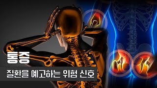 생존 위한 방어 장치 통증 | 통증 | 을지대학교 신경외과 유승준 교수 | 건강플러스