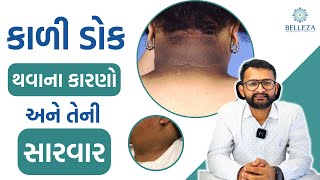 કાળી ડોક થવાના કારણો અને તેની સારવાર | Dark neck | causes \u0026 treatment | Dr. Kirshna Bhalala