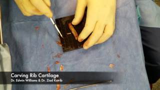 Rib Cartilage Carving - Live Surgical Footage for Rhinoplasty