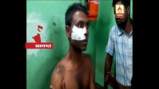 Panchayat Vote: TMC candidate attacked in Habibpur, Maldah