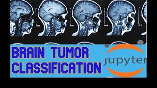 Brain Tumor Classification Using Convolution Neural Network with Augmentation