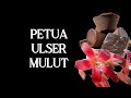 PETUA ULSER MULUT   Bunga Belimbing Buluh