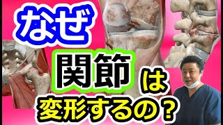 【新常識】骨が変形する理由は体重や加齢ではない！変形から関節を守る方法とは？　もも裏歩きウォーキング協会 第73回