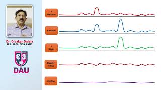 Urodynamic study of Storage Phase of bladder