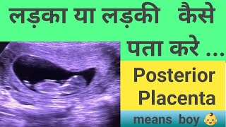 गर्भ में लड़की है या लड़का जानने के तरीके   /  Gender reveal