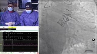 Align for the future with structural heart innovations - Live case and major trial updates - EuroPCR