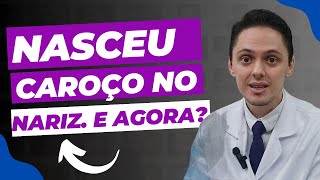 🔥Descubra o que é esse caroço no Nariz e o que fazer? (Otorrino explica)