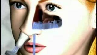 Nasaline Nasal Irrigator