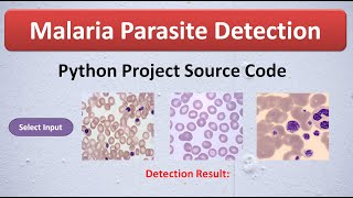Malaria Parasite Detection Using CNN | Deep Learning | Malaria Detection Python Project Code