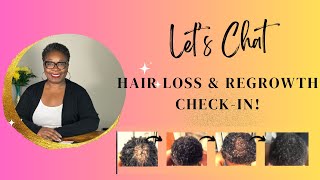 Replay: LIVE CCCA Hair Regrowth Update + Ask Me Anything! Let’s Talk Hair Loss \u0026 ReGrowth Tips!