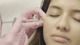 Revanesse Contour Fillers for Cheeks | Skin Institute by Dr. Marina K. | Toronto ON