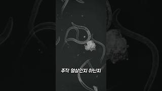 손톱 밑에 있는 악마의 숙주 #확대 #세균 #미생물