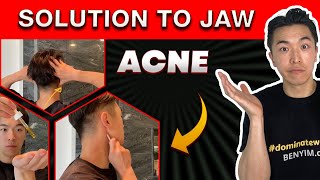 Best way to remove acne from jaw and neck area gua sha tool