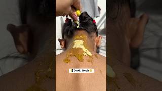 Neck Cleaning Tips \u0026 Trick/Get Rid Of Dark Neck/ Dark Neck Remove Home Remedies #shorts #viralvideo