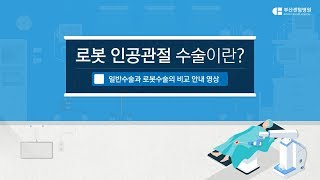 [부산센텀병원] 로봇 인공관절 수술