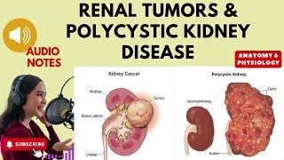 Renal Tumors and Polycystic Kidney Disease. Audio notes.